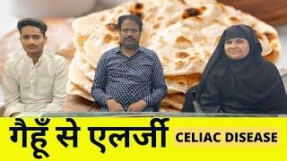 गैहूँ से एलर्जी ॥ Celiac Disease ॥ Dr D L Gangwal ॥ Gangwal Homoeopathy Research Hospital