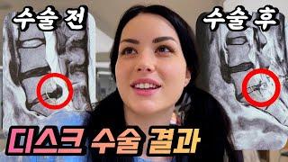 디스크 수술받은 세르비아 아내의 브이로그