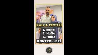 KALÇA PROTEZİ / 1. HAFTA / 2. HAFTA / 6. HAFTA DEĞİŞİM SÜRECİ