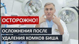  ОСТОРОЖНО! Удаление комков Биша: Возможные осложнения!