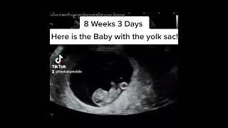 8 weeks and 3 days pregnancy ultrasound!
