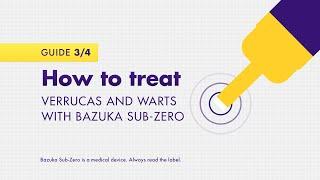 How to treat verrucas and warts with Bazuka Sub-Zero