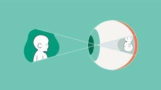 Gene Therapy for Inherited Retinal Diseases