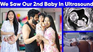 Finally 2nd Baby ka Face Reveal  Baby Ka Face Papa Par Gya 1st time ultrasound mai Baby ko Dekha 🫣