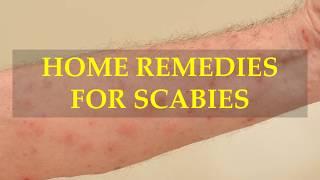 HOME REMEDIES FOR SCABIES