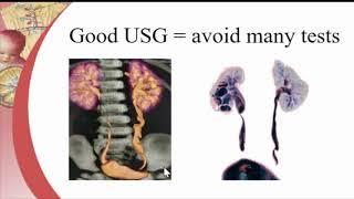 Role of imaging in pediatric urology by Dr  Ramesh Babu