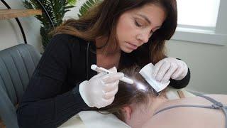 ASMR Ear Cleaning, Hairline Therapy | Scalp Treatment & Ear Personal Attention, Unintentional ASMR