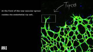 What is angiogenesis?