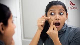Skin Expert FB LIVE Saturday 3:00PM | Free Skin & Hair problems consultation | Feodora NATURAL