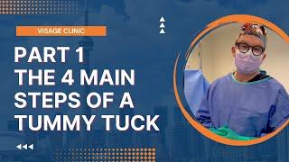 Part 1: 4 Main Steps of a Tummy Tuck | Visage Clinic Toronto