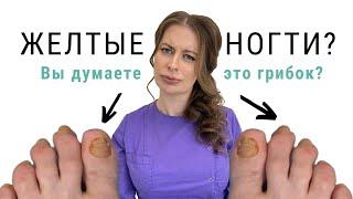 ЖЕЛТЫЕ НОГТИ | ЗАЧИСТКА | ПОДОЛОГ