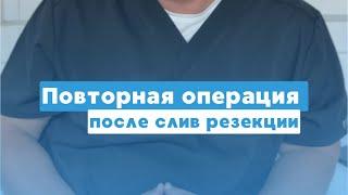 Повторная бариатрическая операция —минигастрошунтирование #бариатрическаяхирургия #повторноеожирение