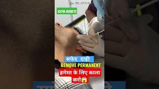 White Beard Hamesha Ke Liye Black?Yeh Treatment Karega Black #awishclinic #shorts #whitebeard