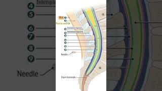#Epidural #Anesthesia , #CSF #collection/#Spinal_anesthesia