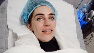MY SURGERY | BEFORE & AFTER  | Lydia Elise Millen