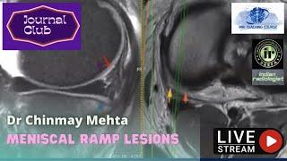 Radiology Journal Club: Dr Chinmay Mehta - Meniscal Ramp Lesions