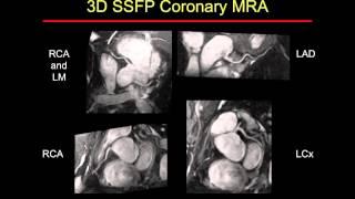MR Angiography Techniques
