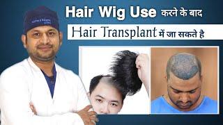 Hair Patch vs Transplant | Cost of Hair Transplant in Bhopal | Hair Transplant Doctor in Bhopal