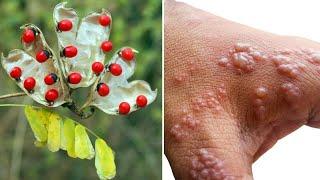 11 Most Poisonous Plants in the World