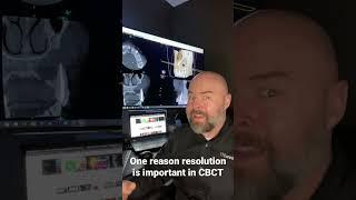 Why is resolution important in CBCT? Here’s one reason.