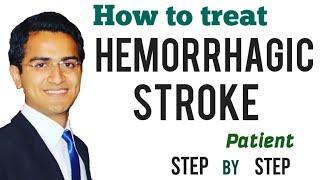 Hemorrhagic Stroke (Intracerebral Hemorrhage) Emergency Treatment Management Medicine Lecture USMLE