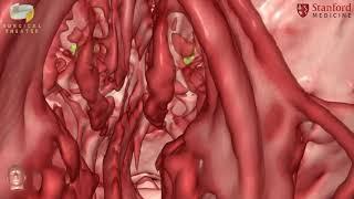 Stanford Neurosurgery Virtual Reality Lab's Anatomy in 3D: Craniopharyngioma