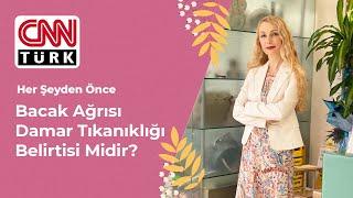 Bacak Ağrısı Damar Tıkanıklığı Belirtisi Midir? I Op. Dr. Arzu Ercan