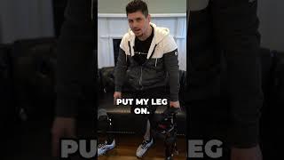 Below Knee Amputee Shares His iWALK Crutch Experience