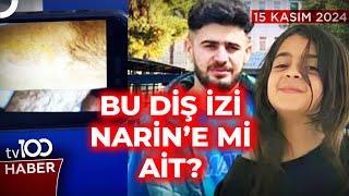 İşte Enes Güran'ın Kolundaki Isırık İzi! | tv100 Ana Haber