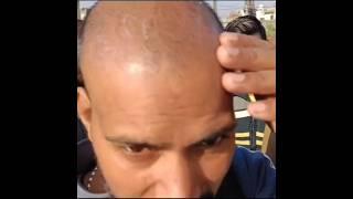 Mister Yaseen balon ki dawai wale meerat mein