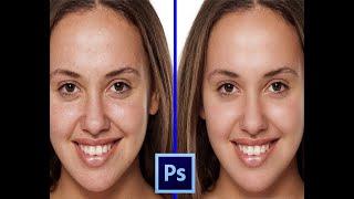 SKIN RETOUCHING//PHOTOSHOP TUTORIAL//TECHNICAL SUVO