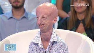 Sammy Basso, dalla lotta alla progeria alla laurea con lode - La vita in diretta estate 24/07/2018