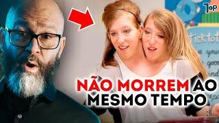 O que acontece se um gêmeo siamês morrer e o outro continuar vivendo? | P&R