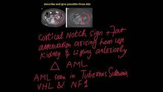 RADIOLOGY CASES OF THE DAY IN ENGLISH