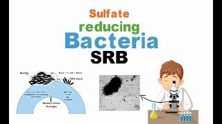 SRB bacteria | Yazenkom