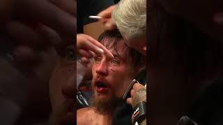 Bare Knuckle Boxing  #ukbkb #bareknuckle #bkb
