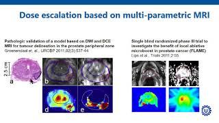 ISMRM MR Academy - MR-Guided Radiotherapy