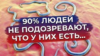 Что такое паразитоз? / Симптомы, лечение и профилактика паразитоза!