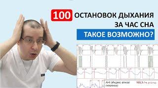 100 ОСТАНОВОК ДЫХАНИЯ В ЧАС! | Разбор реального случая тяжелой формы сонного апноэ