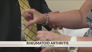 Signs you may have rheumatoid arthritis