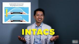 What Are Intacs And Is It Worth It?