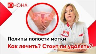 Полипы полости матки. Как лечить? Стоит ли удалять полипы?