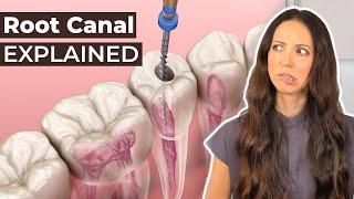 What Is A Root Canal & Should You Get One