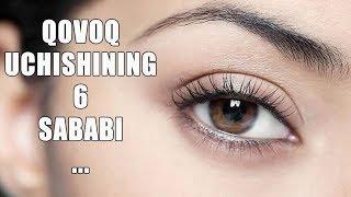 Ковок Учишининг 6 Сабаби ...