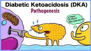 Diabetic Ketoacidosis (DKA) Pathogenesis