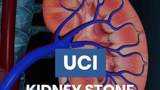 Minimally Invasive Stone Removal Specialists - UCI Department of Urology Kidney Stone Center