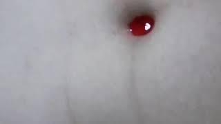 Belly button play 88