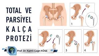 Total ve Parsiyel Kalça Protezi - Prof. Dr. Kamil Çağrı Köse