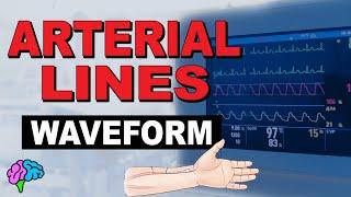 The Arterial Line Waveform EXPLAINED!