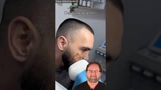 CO2 Laser Self Treatment- Surgeon Reacts